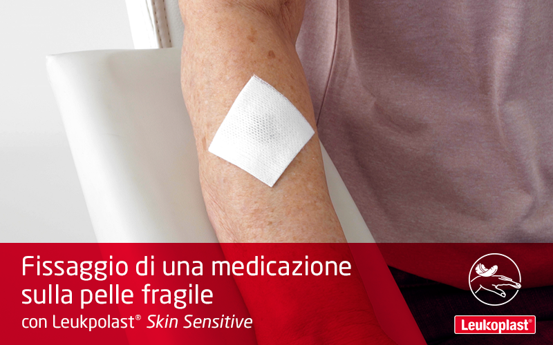 Qui vediamo come applicare e riposizionare una medicazione sulla pelle molto sensibile con un cerotto su rocchetto: un operatore sanitario fissa un tampone sull'avambraccio di una signora con pelle fragile, utilizzando Leukoplast Skin Sensitive. Qui vediamo come applicare e riposizionare una medicazione sulla pelle molto sensibile con un cerotto su rocchetto: un operatore sanitario fissa un tampone sull'avambraccio di una signora con pelle fragile, utilizzando Leukoplast Skin Sensitive.
